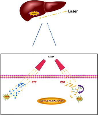 Photodynamic and Photothermal Therapy of Hepatocellular Carcinoma